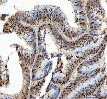 PCNA Rabbit Polyclonal Antibody