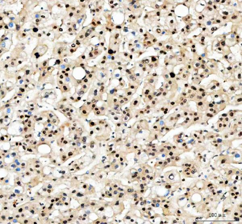 PCNA Rabbit Polyclonal Antibody