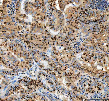 PCNA Rabbit Polyclonal Antibody