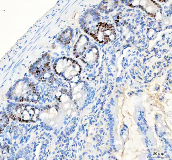 PCNA Rabbit Polyclonal Antibody