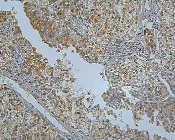 PCSK9 Rabbit Polyclonal Antibody