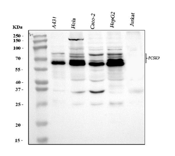 PCSK9 Rabbit Polyclonal Antibody