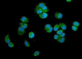 p23/PTGES3 Rabbit Polyclonal Antibody