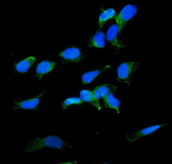 Radixin/RDX Rabbit Polyclonal Antibody