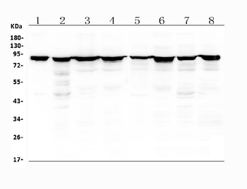 Radixin/RDX Rabbit Polyclonal Antibody