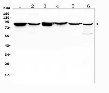 Radixin/RDX Rabbit Polyclonal Antibody