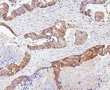 SKP1 Rabbit Polyclonal Antibody