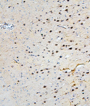 SKP1 Rabbit Polyclonal Antibody