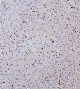 SKP1 Rabbit Polyclonal Antibody