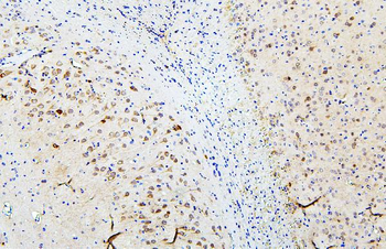 SKP1 Rabbit Polyclonal Antibody