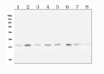 SKP1 Rabbit Polyclonal Antibody