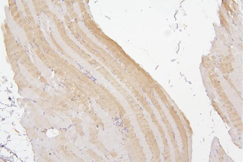 Tafazzin/TAZ Rabbit Polyclonal Antibody