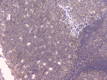 Osteoprotegerin/TNFRSF11B Rabbit Polyclonal Antibody