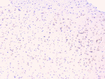 Osteoprotegerin/TNFRSF11B Rabbit Polyclonal Antibody