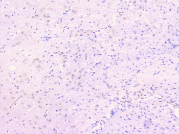 Osteoprotegerin/TNFRSF11B Rabbit Polyclonal Antibody