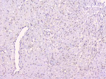 Osteoprotegerin/TNFRSF11B Rabbit Polyclonal Antibody