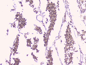 Osteoprotegerin/TNFRSF11B Rabbit Polyclonal Antibody