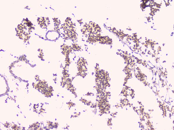 Osteoprotegerin/TNFRSF11B Rabbit Polyclonal Antibody