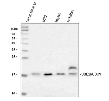 UBE2I/UBC9 Rabbit Polyclonal Antibody