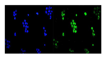 UBE2I/UBC9 Rabbit Polyclonal Antibody