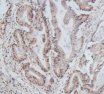 UBE2I/UBC9 Rabbit Polyclonal Antibody