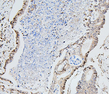 UBE2I/UBC9 Rabbit Polyclonal Antibody