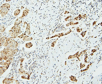 UBE2I/UBC9 Rabbit Polyclonal Antibody