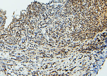 UBE2I/UBC9 Rabbit Polyclonal Antibody