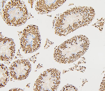 UBE2I/UBC9 Rabbit Polyclonal Antibody
