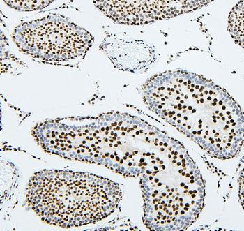 UBE2I/UBC9 Rabbit Polyclonal Antibody