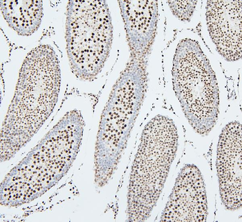 UBE2I/UBC9 Rabbit Polyclonal Antibody