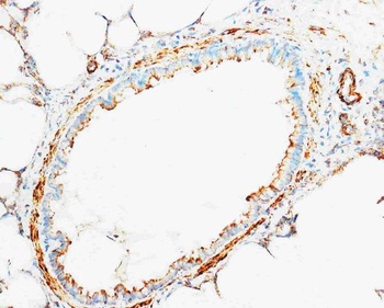 Cytochrome C/CYCS Rabbit Polyclonal Antibody