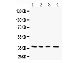 MTCO1/MT-CO1/MT Rabbit Polyclonal Antibody