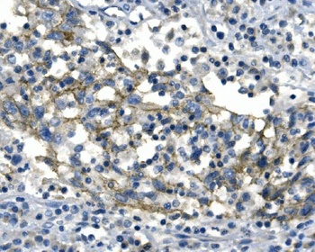 Desmoglein 2/DSG2 Rabbit Polyclonal Antibody