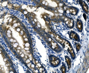 Desmoglein 2/DSG2 Rabbit Polyclonal Antibody