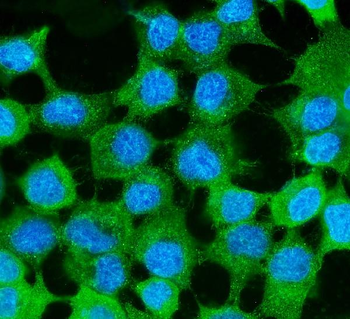 MVP Mouse Monoclonal Antibody