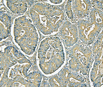 MVP Mouse Monoclonal Antibody