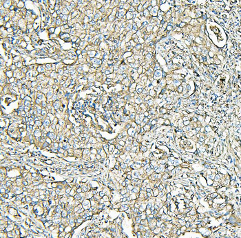 MVP Mouse Monoclonal Antibody