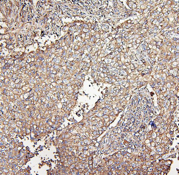 MVP Mouse Monoclonal Antibody