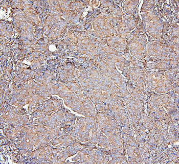 MVP Mouse Monoclonal Antibody