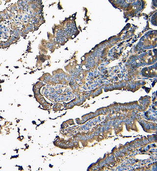 MVP Mouse Monoclonal Antibody