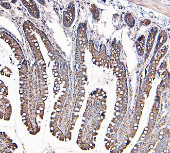 MVP Mouse Monoclonal Antibody