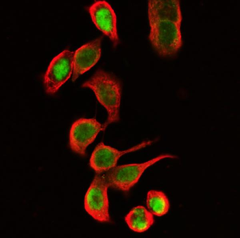 Beta Tubulin TUBB Mouse Monoclonal Antibody