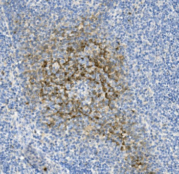 NCR1 Rabbit Polyclonal Antibody