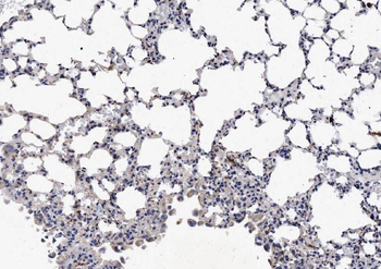 NCR1 Rabbit Polyclonal Antibody
