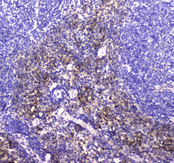 NCR1 Rabbit Polyclonal Antibody