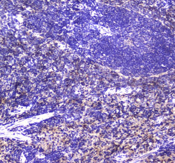 NCR1 Rabbit Polyclonal Antibody