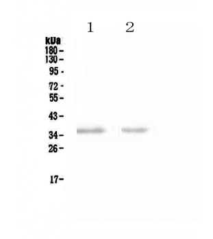 NCR1 Rabbit Polyclonal Antibody