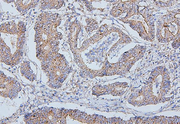 ALIX/PDCD6IP Mouse Monoclonal Antibody