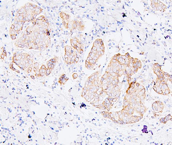 ALIX/PDCD6IP Mouse Monoclonal Antibody